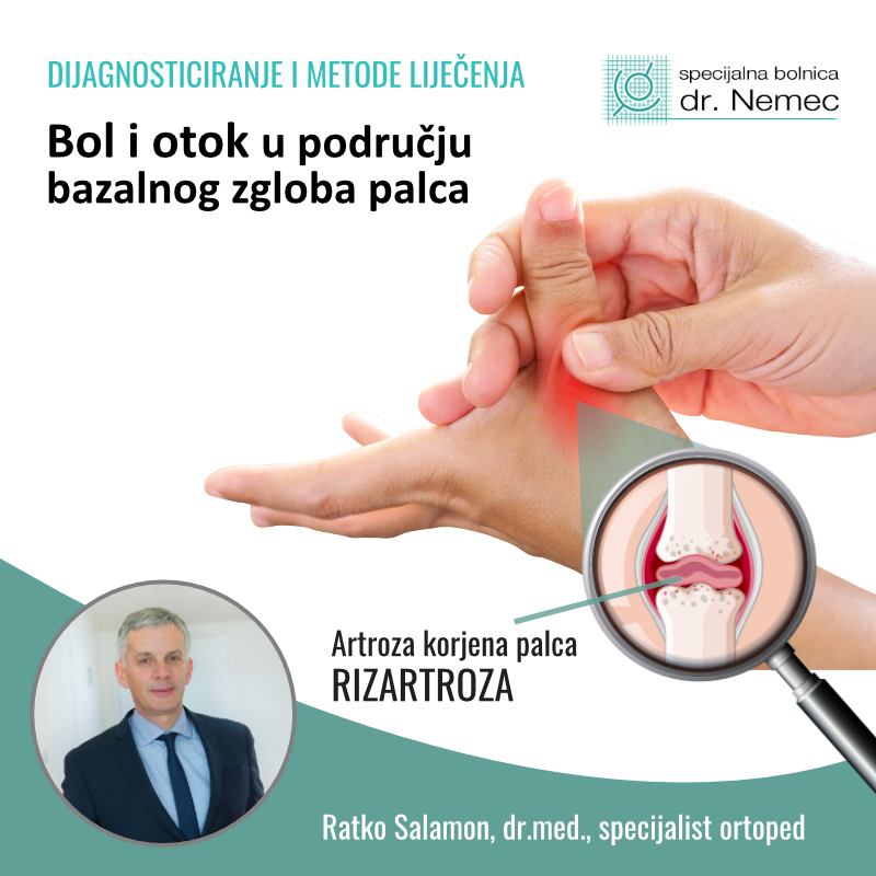 ručni forum za liječenje artroze)